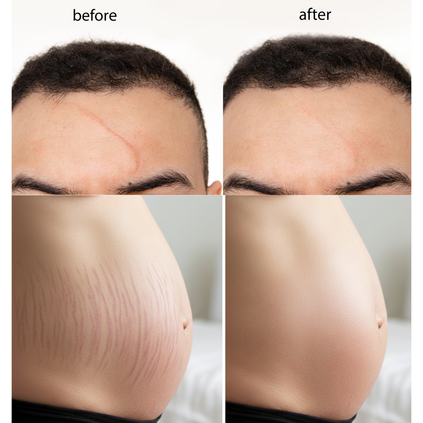 ROYAL HONEY TALLOW – Cebo de Res + Miel de Manuka